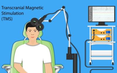What is Transcranial Magnetic Stimulation (TMS)?